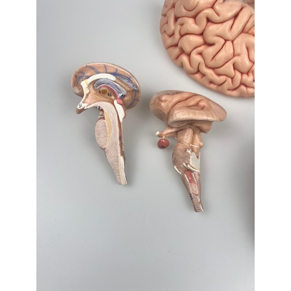 Vintage Somso Germany Anatomical Teaching Model | Human Brain | 6 Parts | Oddity - Picture 9 of 9